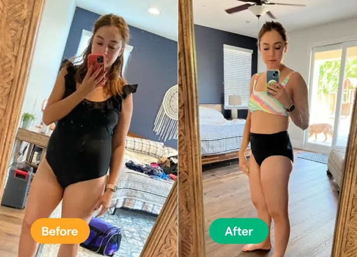 Before and After - Nicole R.